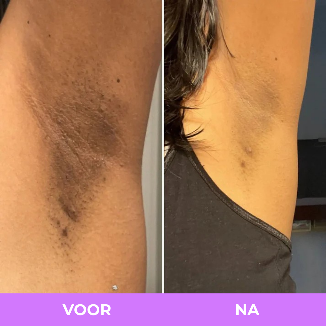 Arelia Spray met Kurkuma en Kojiczuur