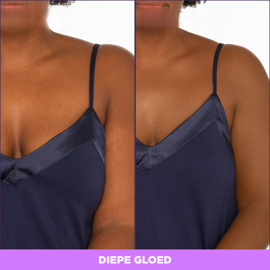 Arelia Dekking voor het lichaam