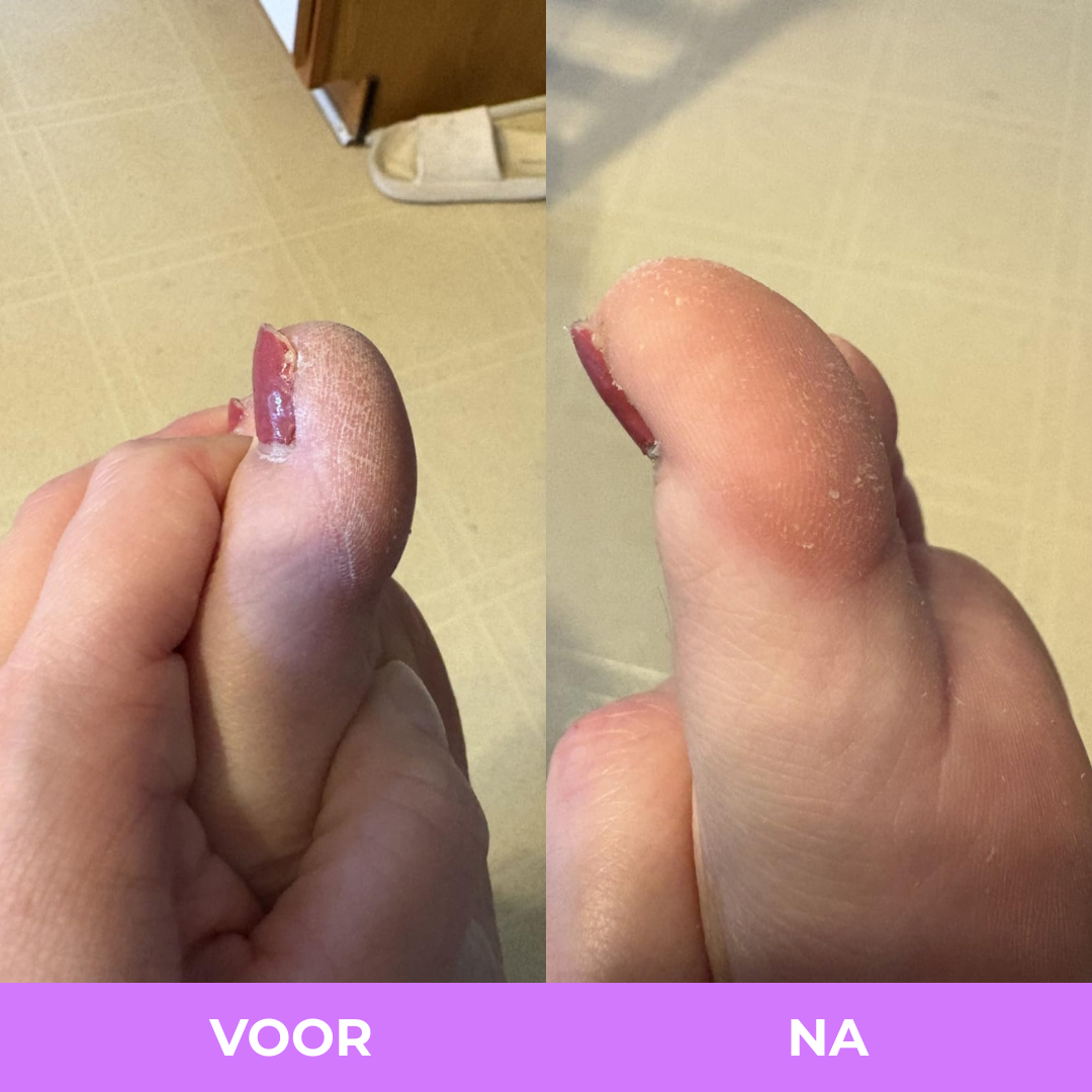 Arelia Spray met Kurkuma en Kojiczuur