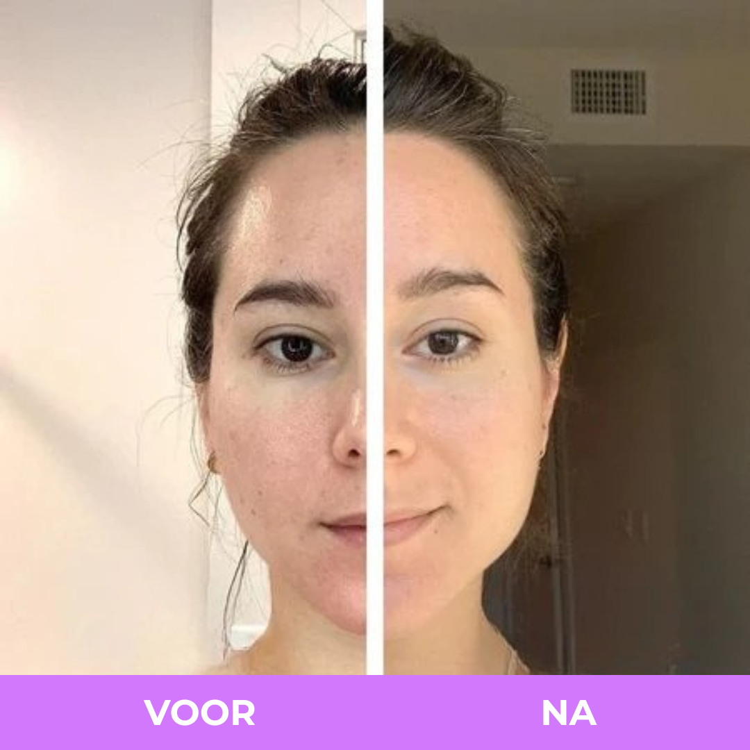 Arelia Spray met Kurkuma en Kojiczuur